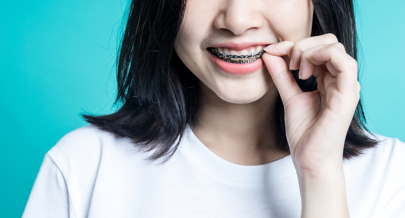 woman wearing dental braces
