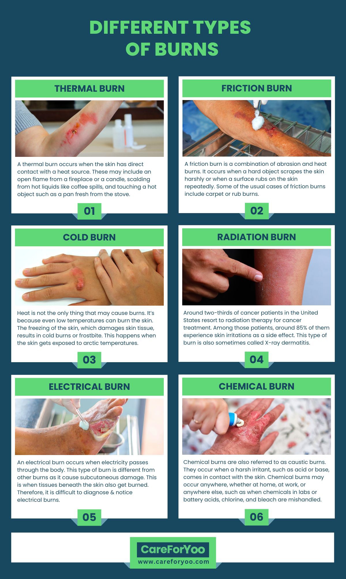 Different Types of Burns