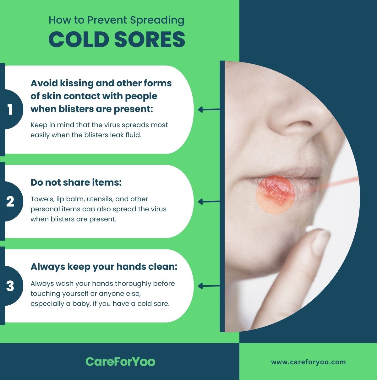 How to Prevent Spreading Cold Sores