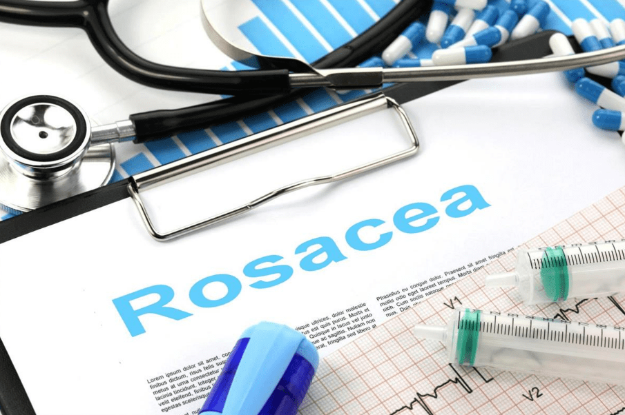 Rosacea-word-on-a-clipboard
