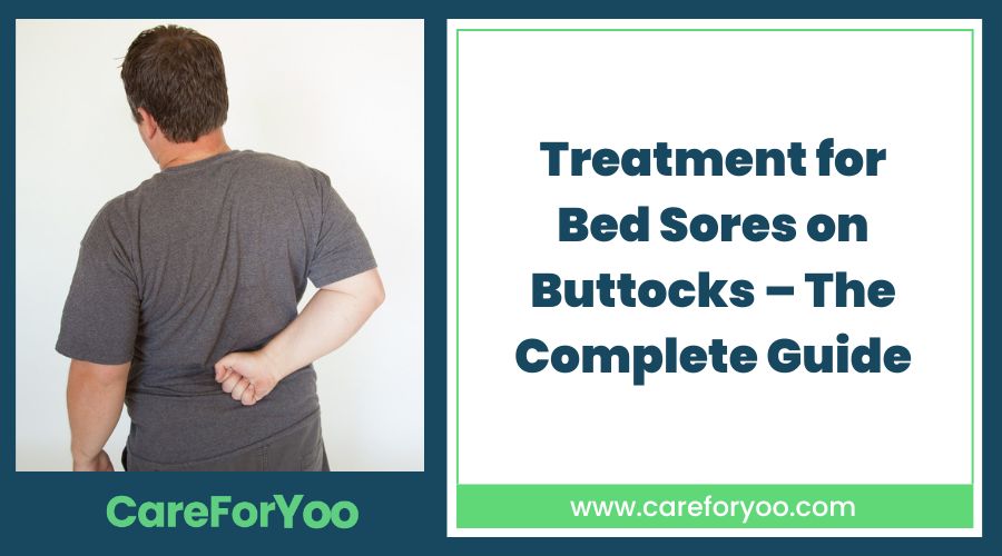 Treatment for Bed Sores on Buttocks–The Complete Guide