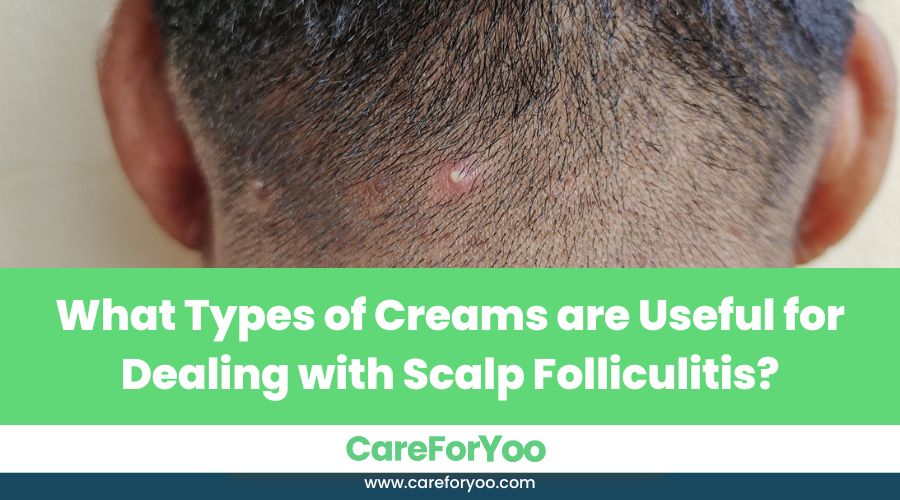 What Types of Creams are Useful for Dealing with Scalp Folliculitis?