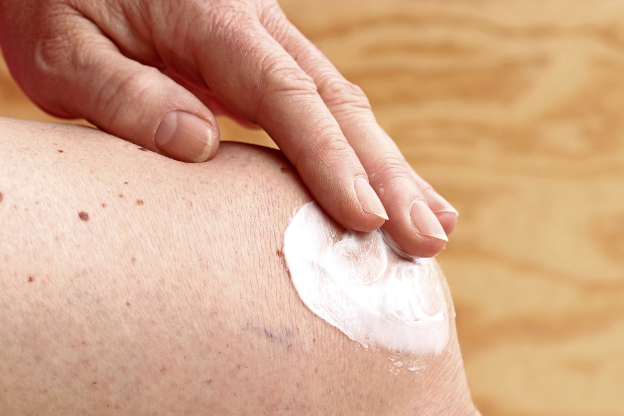 applying pain relief cream on the knee