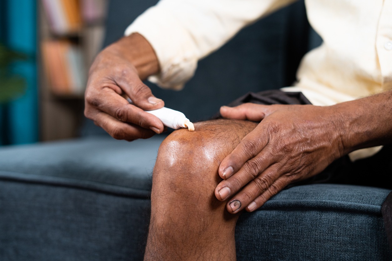 man applying cream on his knee