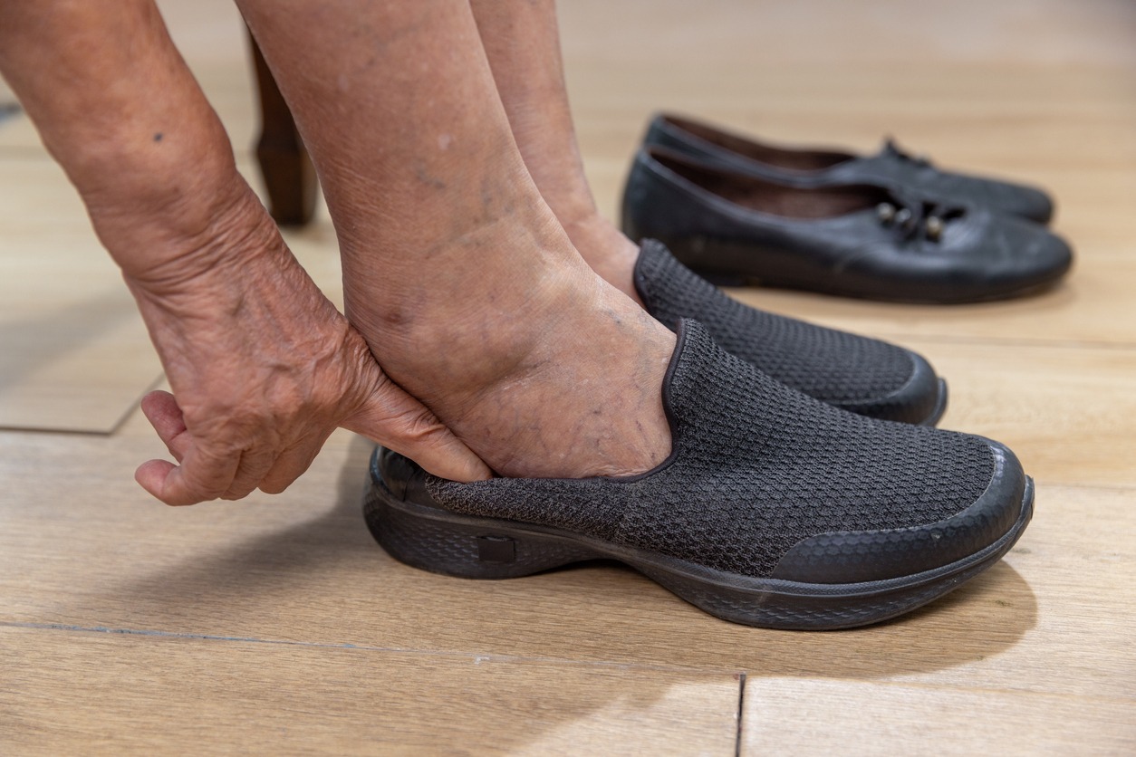 orthopedic shoes for treating varicose veins