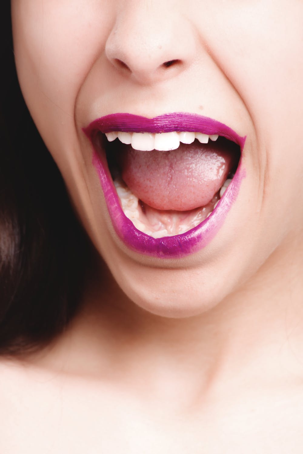 woman-teeth