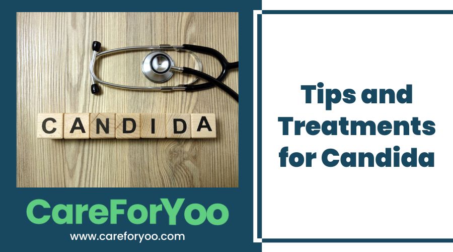 Tips and Treatments for Candida