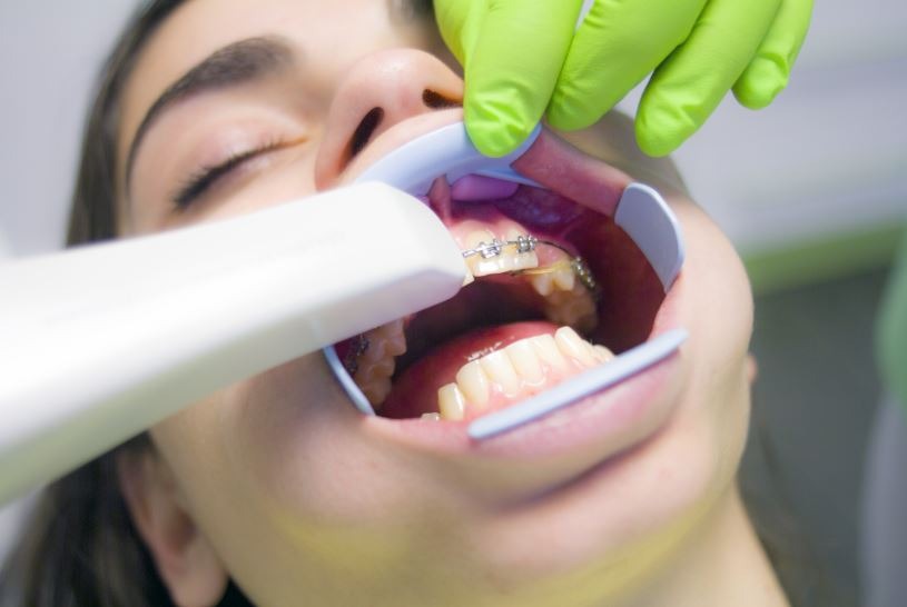 Dentist, Dentistry, 3d Scan