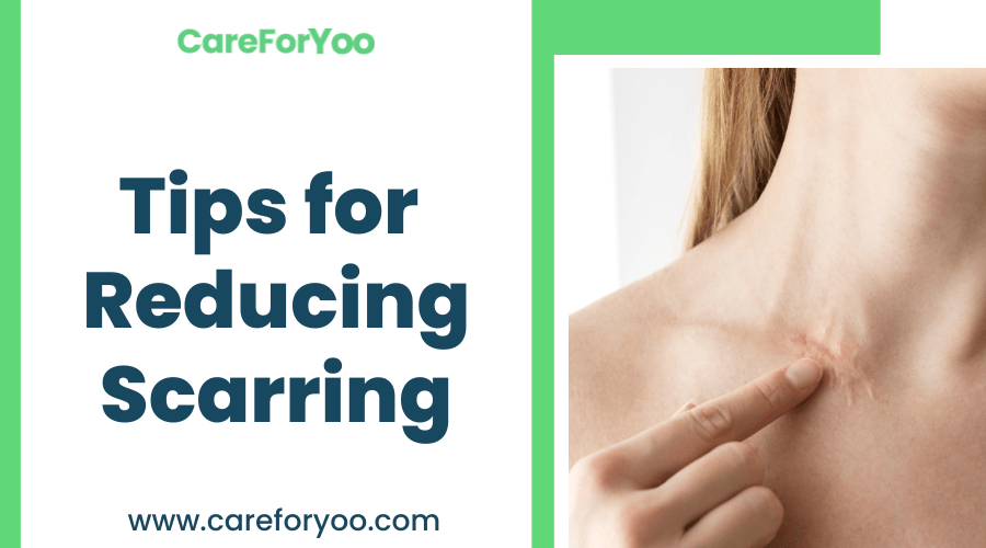 Tips for Reducing Scarring