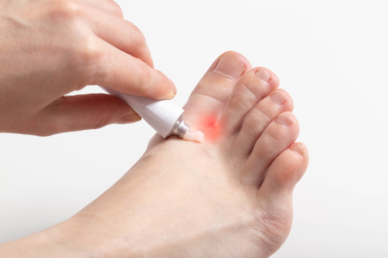 person applying cream on foot