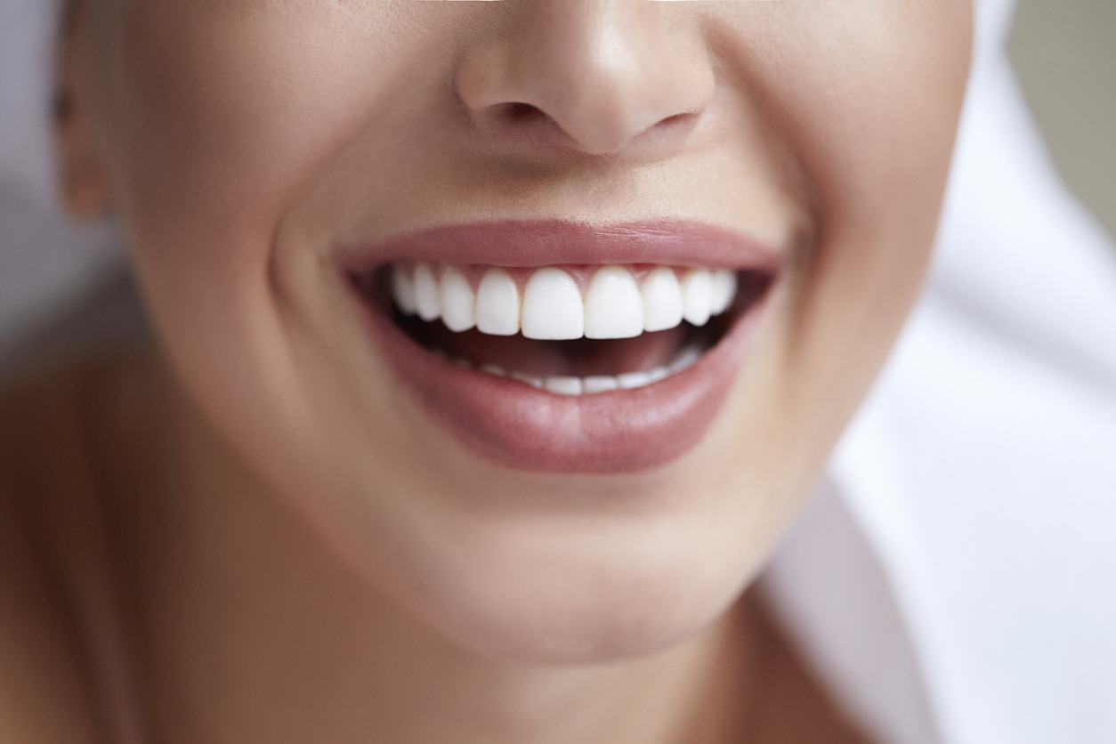 woman with white teeth smiling