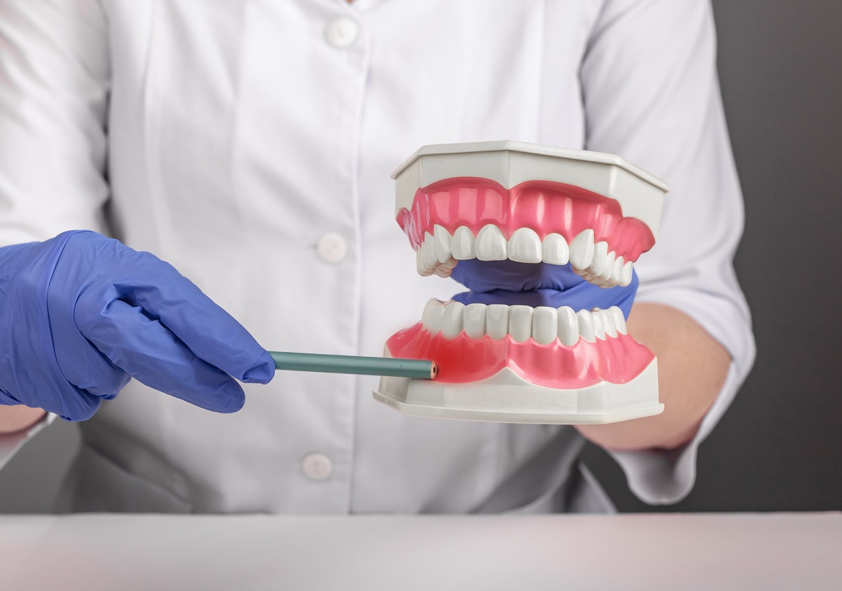 dentist showing gum inflammation on teeth model