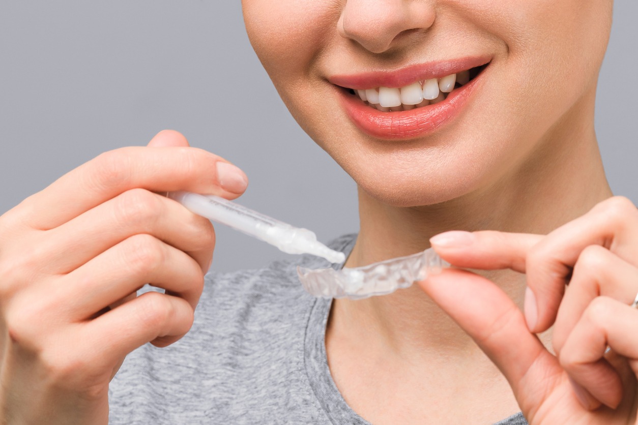 woman applying gel on a teeth-whitening tray